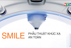 Phẫu thuật Khúc xạ an toàn – Khoa Khúc xạ Bệnh viện Mắt TP HCM – HTV9