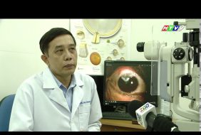 CHƯƠNG TRÌNH ƯU ĐÃI PHẪU THUẬT ABiC TRONG ĐIỀU TRỊ GLAUCOMA
